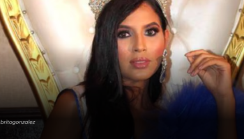 Fallece modelo venezolana tras cirugía maxilofacial